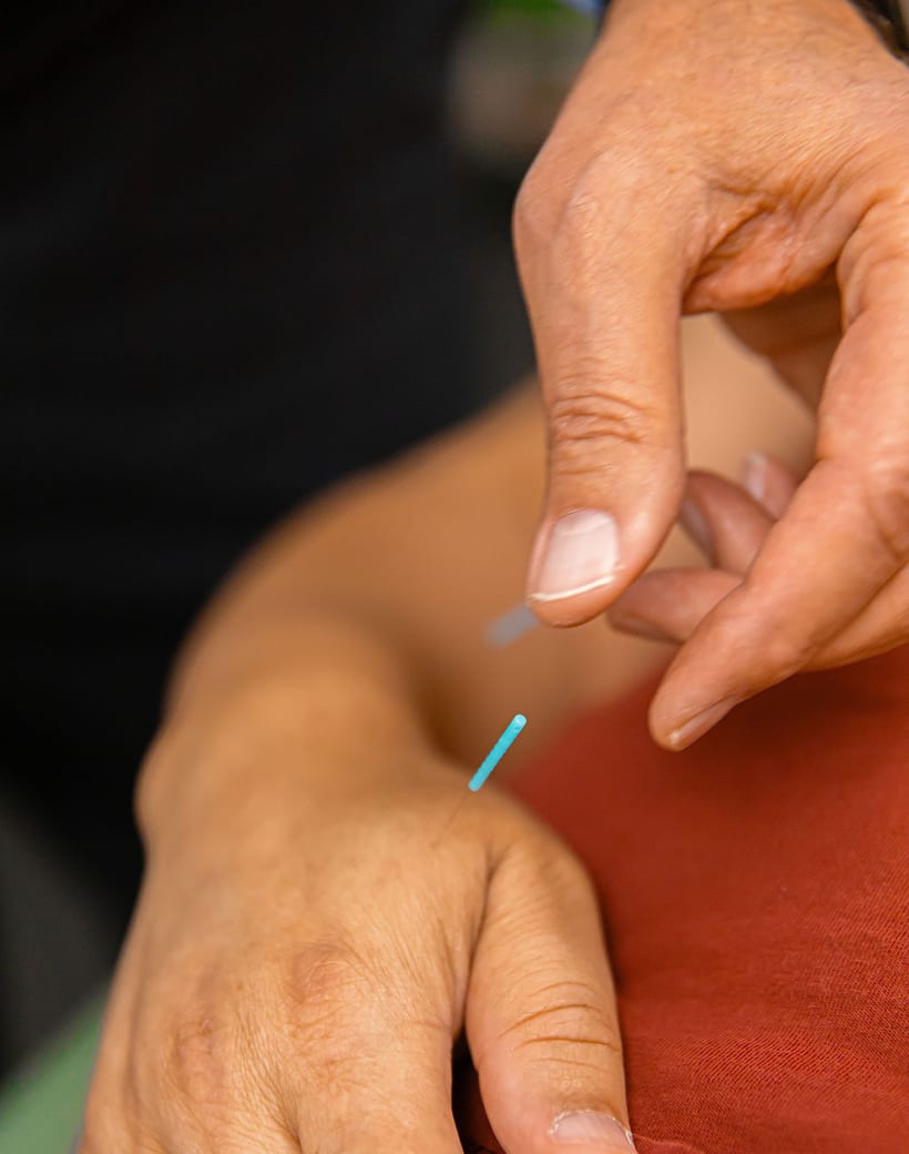 Acupuncture care
